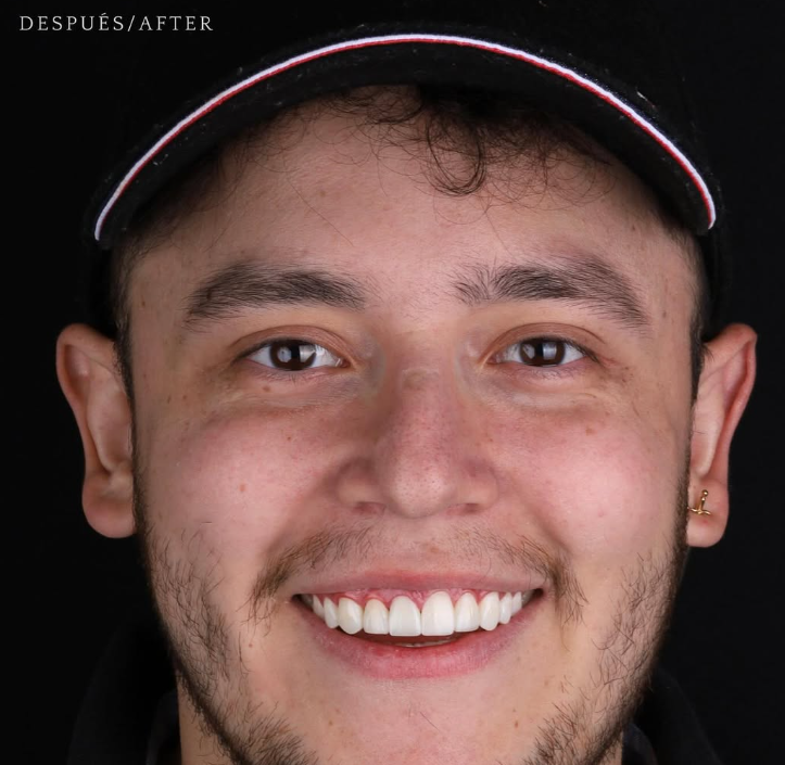 Caso 01 · Después