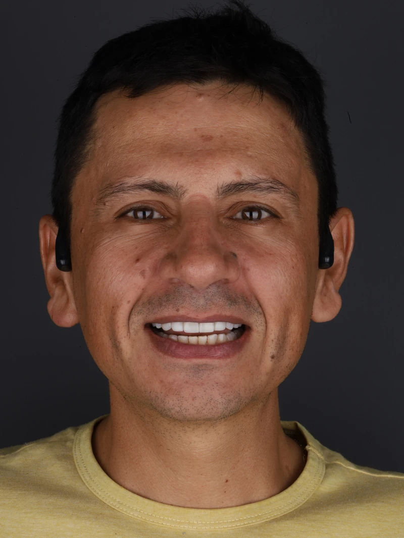 Camilo · Después